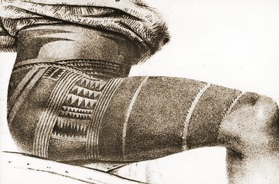 Cuisse d